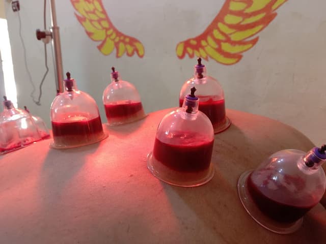 مركز تداوي للعلاج الطبيعي والتأهيل د/ حسن عاصم الجزار