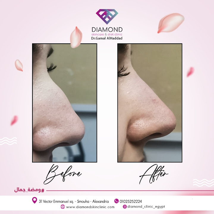 Diamond Clinic دكتور جمال الحداد للتجميل