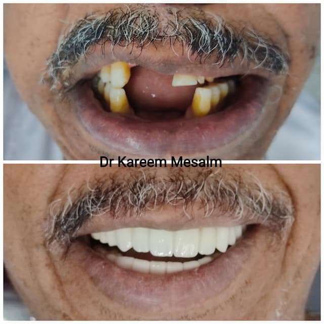 مركز سمايل هوم لزراعة وتجميل الفم والأسنان