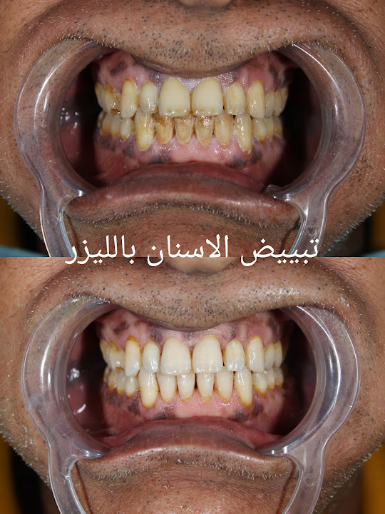 Green Dental Center - Dr Mohab Sherif