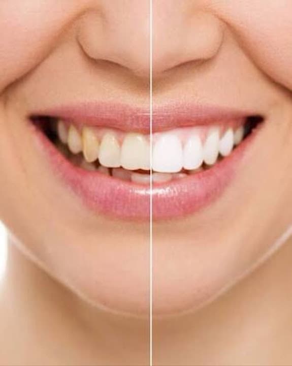 Professors Dental Clinic - عيادة بروفيسورز لزراعة وتجميل الأسنان