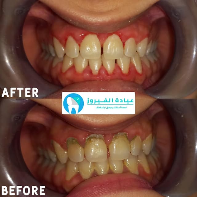 عيادة الفيروز لطب الأسنان AlFayrouz Dental Clinic