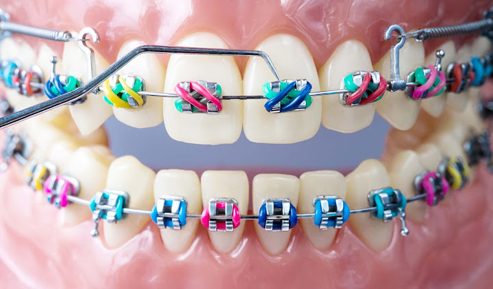 smile of hope dental center - مركز ابتسامة الامل لطب الاسنان