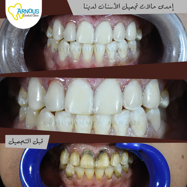 Dr. Mohammed Arnous Center for Cosmetic Dentistry