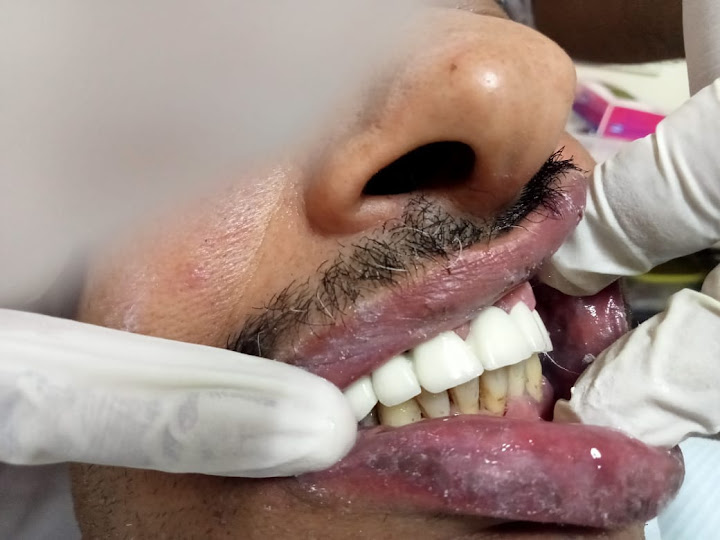 عيادة الفلكى للاسنان و التركيبات الفورية Falaky Dental Clinic