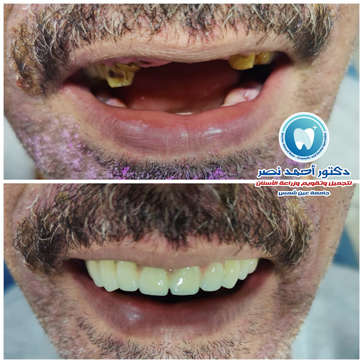 عيادة دكتور احمد نصر لتجميل و تقويم و زراعة الاسنان