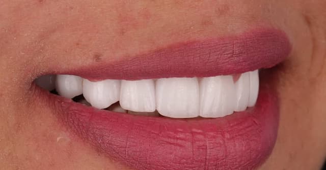 Dr.Wael Badr - Asnan Dental Care د وائل بدر