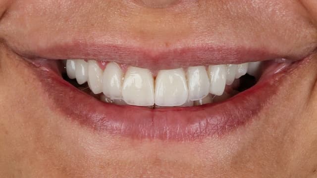 Joy Dental Center مركز چوي لزراعة وتجميل الأسنان فرع مدينة نصر