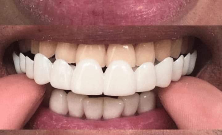 مركز تقويم وزراعة الأسنان دكتور مجدى عبدالحميد الشوري