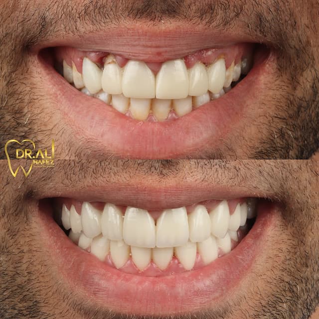 Dr Ali Hafez Dental Clinic د/علي حافظ