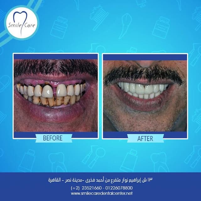 Smile Care