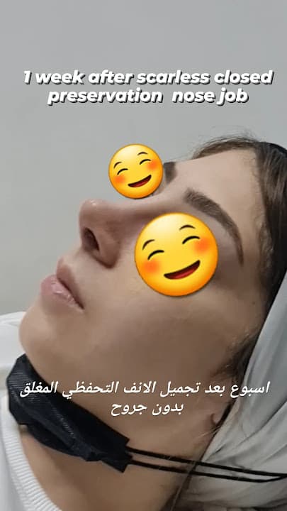 مركز افارا - دكتور تجميل الانف و نحت الجسم و عمليات تصغير و تكبير الثدي و شفط الدهون و تجميل الوجه