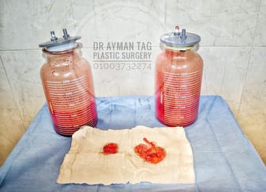 دكتور أيمن تاج اخصائي جراحات التجميل و تنسيق القوام Dr Ayman Tag Plastic Surgery Specialist