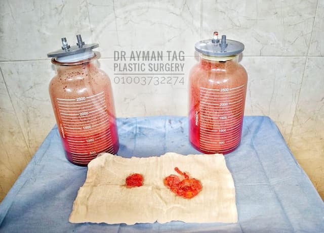 دكتور أيمن تاج اخصائي جراحات التجميل و تنسيق القوام Dr Ayman Tag Plastic Surgery Specialist