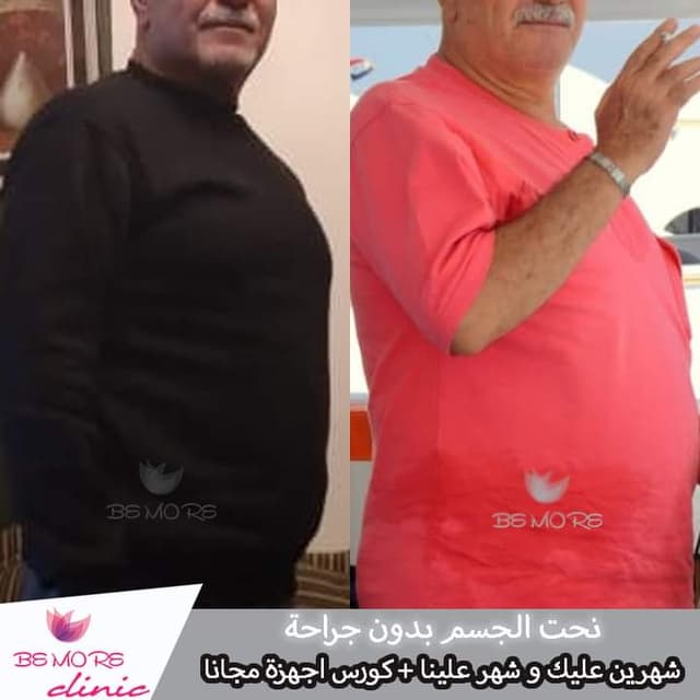 عيادة د/ رائد محمد للعلاج الطبيعي