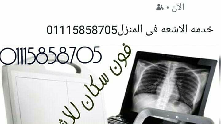 اشعه