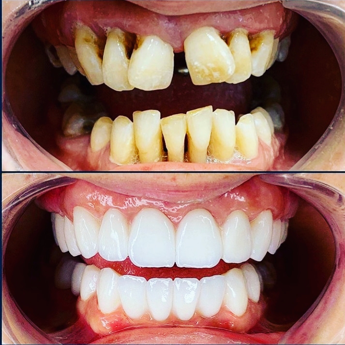 عيادة رويال العاشر للأسنان دكتور نادر عمر Dr Nader Omar Royal dental clinic