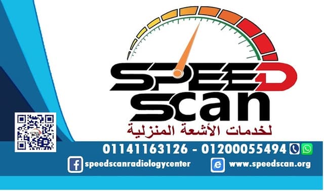 اشعة منزلية