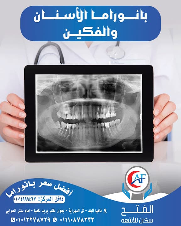 مركز الفتح سكان للأشعة بناهيا