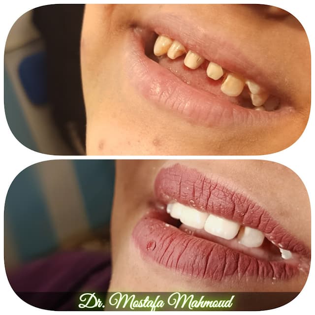 عيادة بشتيل للاسنان