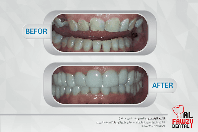 AL Fawzy Dental Clinic