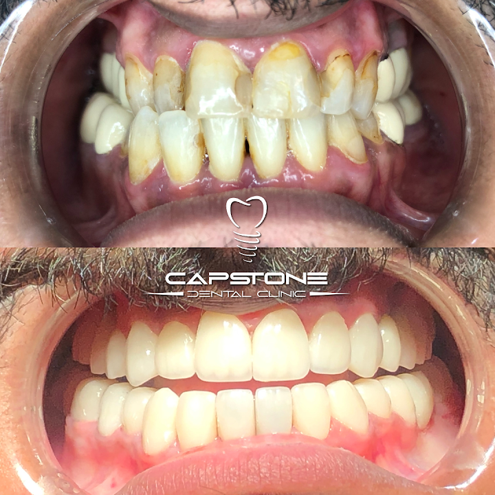 CAPSTONE DENTAL CLINIC