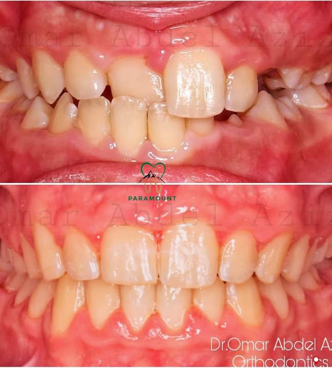 Paramount Dental Clinic | عيادة د.أحمد مجدي للأسنان