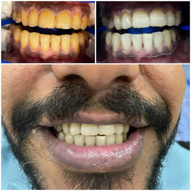 Dental House دكتور. سامر مصطفي