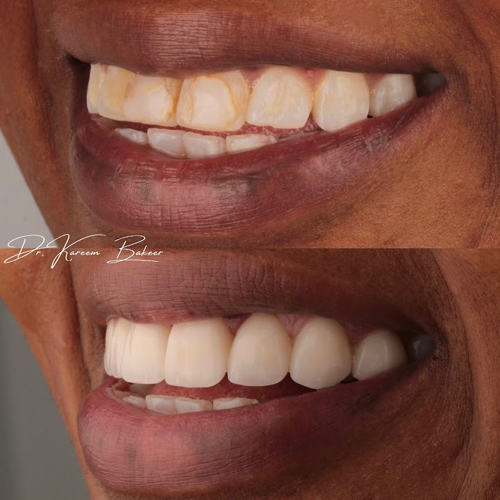 Dr. Kareem Bakeer Asnan Dental عياده اسنان د/ كريم بكير