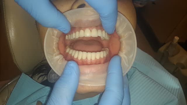 INTEGRATED dental clinic: د.نجاة عبد الفتاح و د. مى محمد dental clinic