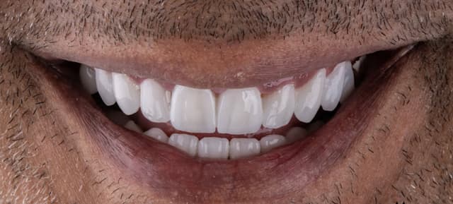 DentoCare Dental Clinic