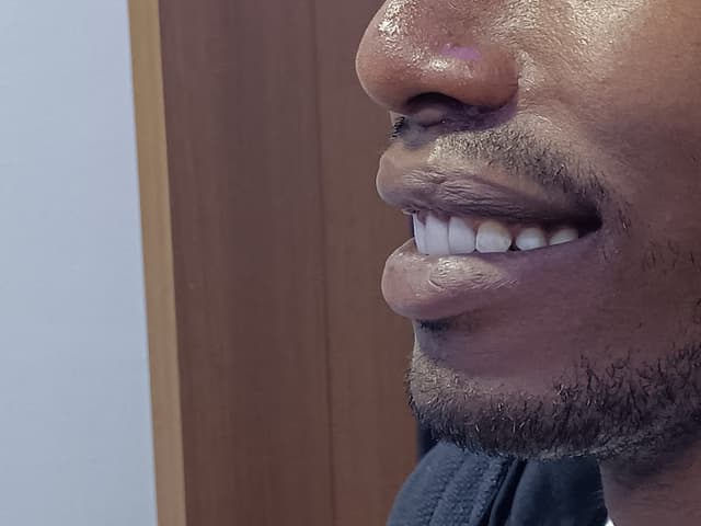 Mood Dent Clinics _ عيادات موود لطب الاسنان