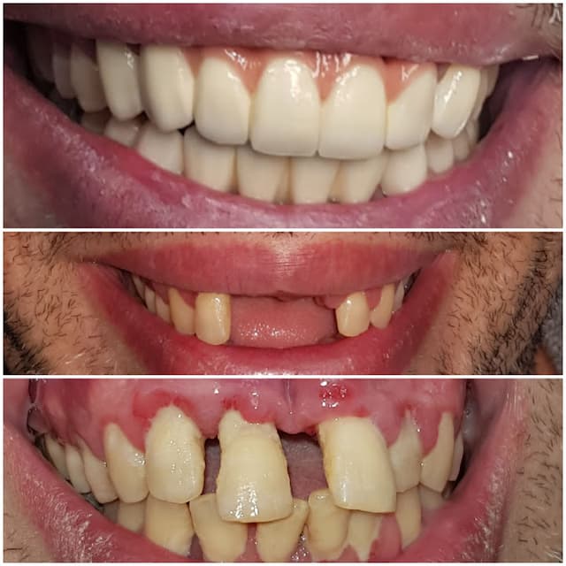 You Smile Dr. Usama Taema Dental Clinic