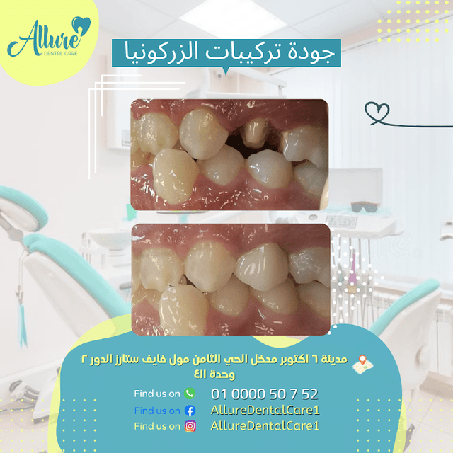 Allure Dental Care