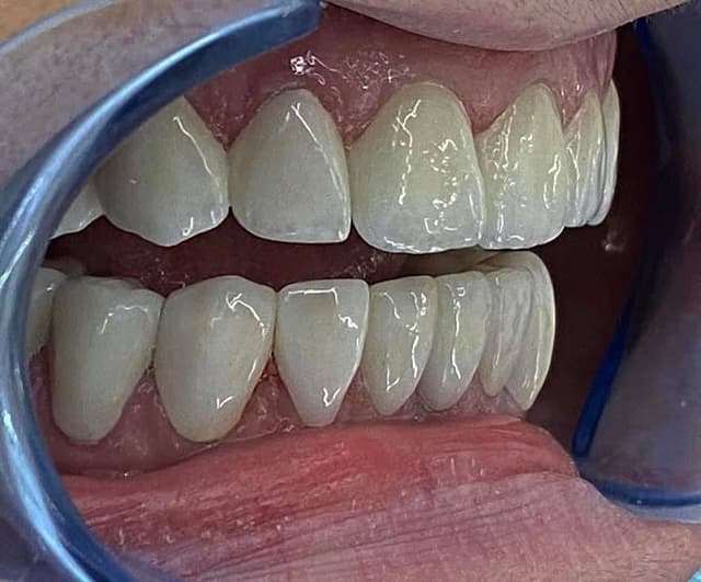 Dr. Anas Fathy Dental Clinic - د. أنس فتحي لعلاج و تجميل الأسنان. الشيخ زايد