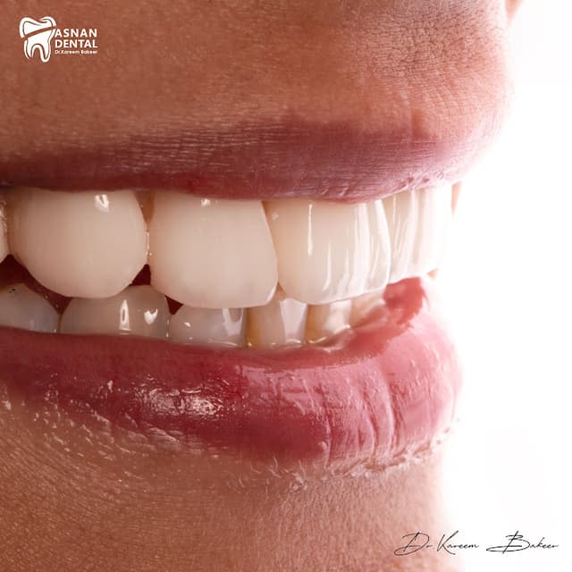 Dr. Kareem Bakeer “Asnan Dental Sheikh Zayed “ عياده اسنان د/ كريم بكير