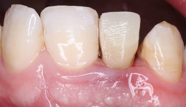 Badr Dental Center - دكتور أحمد عبدالله بدر