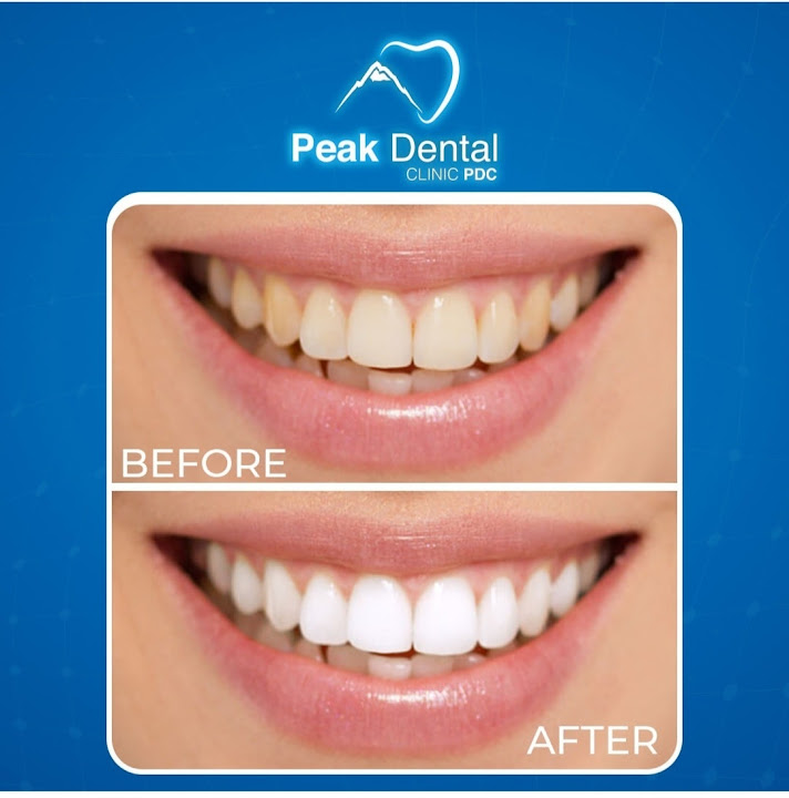 Peak Dental Clinic