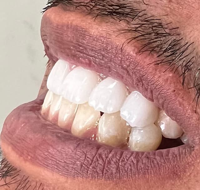 Dentalist clinic- Dr. Mostafa Qamar دكتور مصطفي قمر -عيادة دنتالست