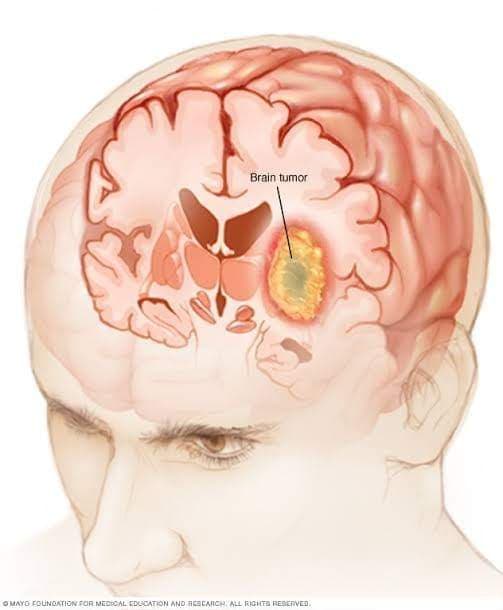 EG Neurosurgery عيادات مصرية