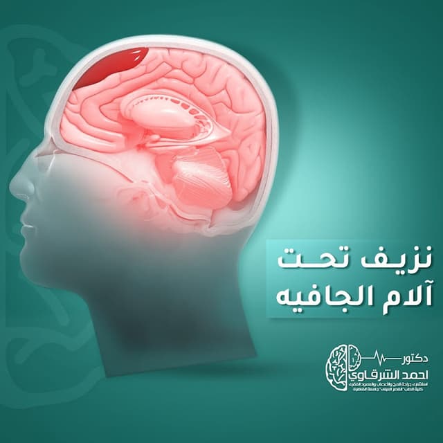 دكتور أحمد الشرقاوي استشاري جراحة المخ والاعصاب والعمود الفقري