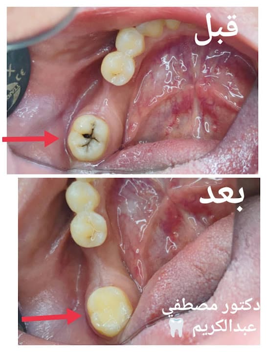 عيادة الدكتور مصطفي عبدالكريم لطب الفم والاسنان