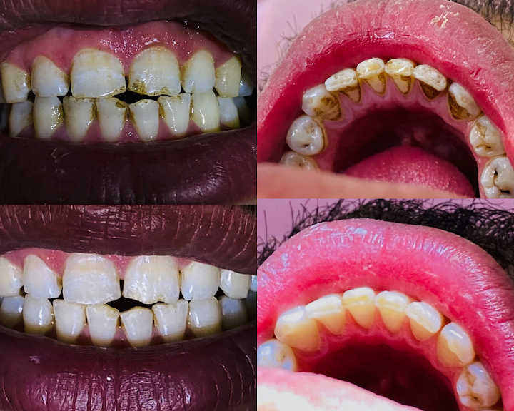 مركز اوباليسينس للاسنان