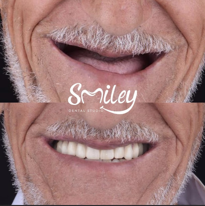 Smiley dental studio (Dr.Abdelrhman tarek) عيادات سمايلي لزراعة و تقويم الاسنان