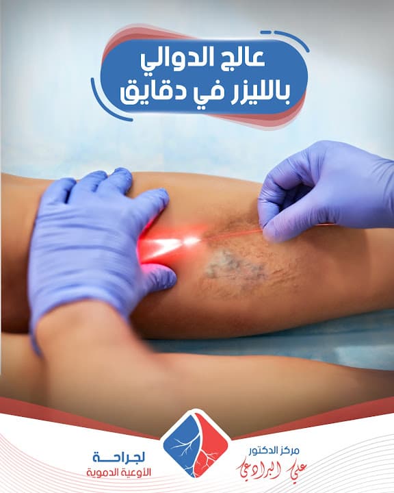 دكتور علي البرادعي لجراحة الأوعية الدموية والقسطرة الطرفية والقدم السكري