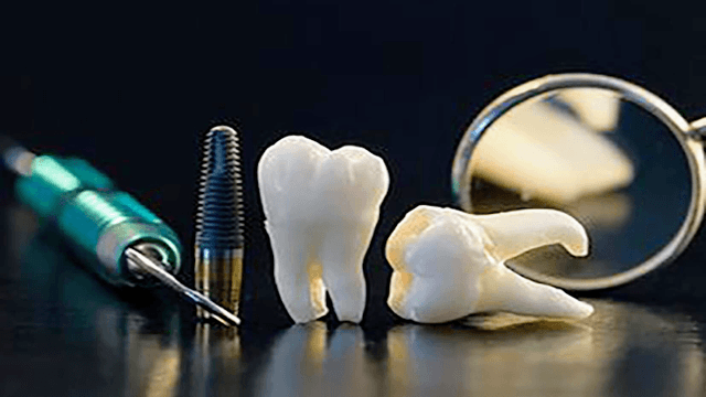 عيادة د.مصطفى نبهان لطب وجراحات الفم والأسنان والتجميل