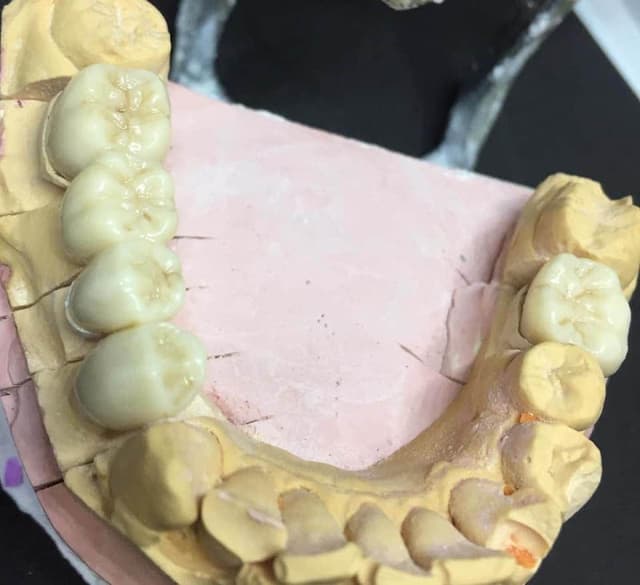 عياده اسنان كفرشكر