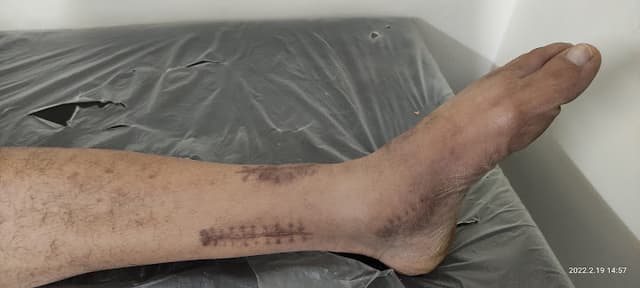 عيادة د حسام أحمد عطية لجراحات العظام و اليد