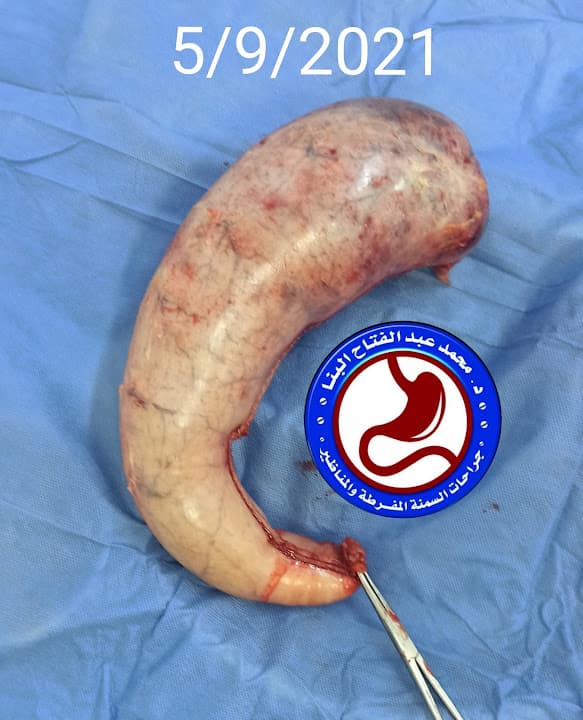 مركز دكتور محمد البنا للجراحة العامة والمناظير