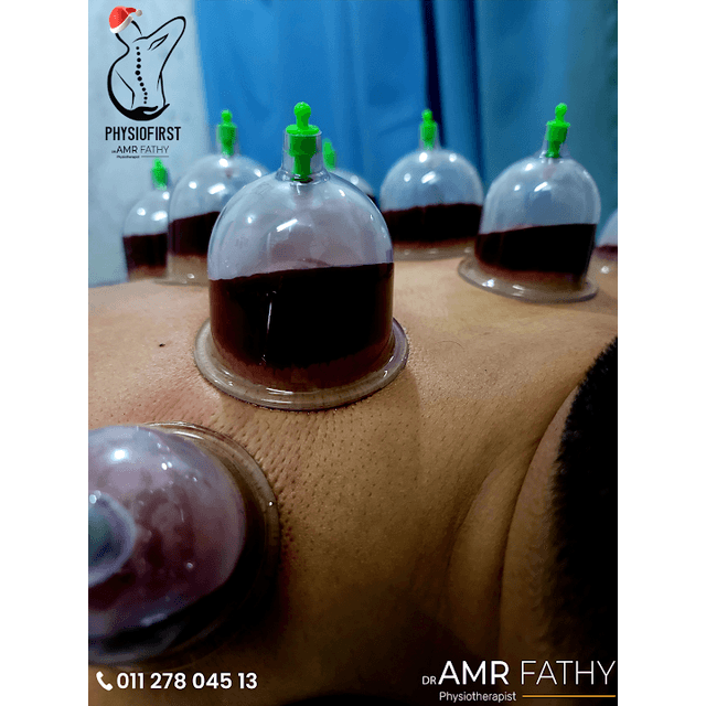 عيادة دكتور عمرو فتحي للعلاج الطبيعي